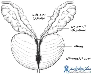 استیج سرطان پروستات