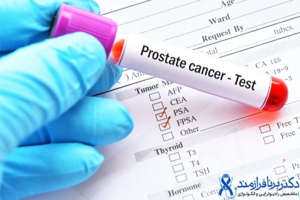 غربالگری سرطان پروستات با آزمایش PSA و FPSA (PSA آزاد)