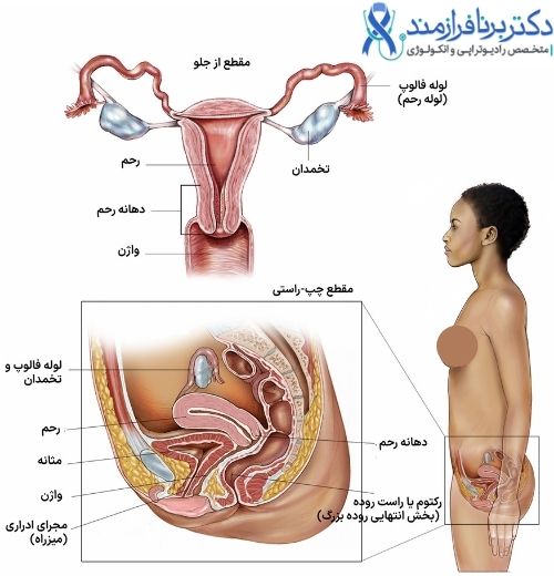 آناتومی زنان، رحم، آندومتر، سرویکس، دهانه رحم، تخمدان
