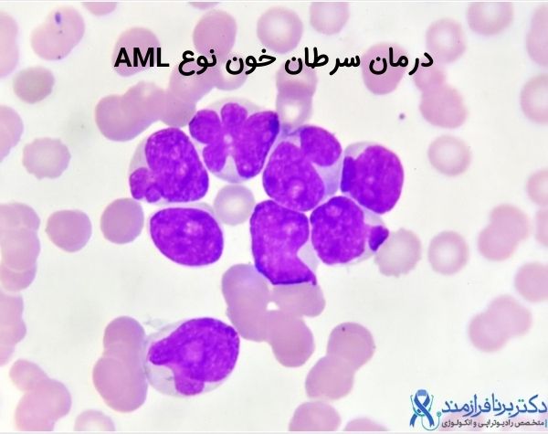 درمان AML،‌ درمان سرطان خون
