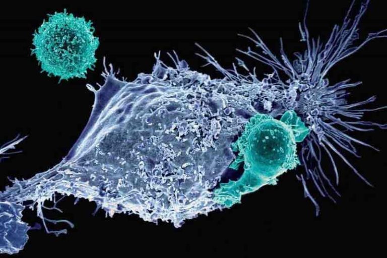 ایمونوتراپی سرطان - سلول‌های ایمنی در حال جنگیدن با سرطان