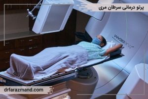 پرتو درمانی سرطان مری، رادیوتراپی کانسر مری