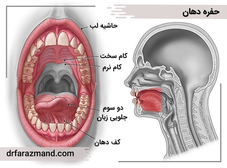 سرطان دهان چیست و چگونه ایجاد میشود؟، حفره دهان