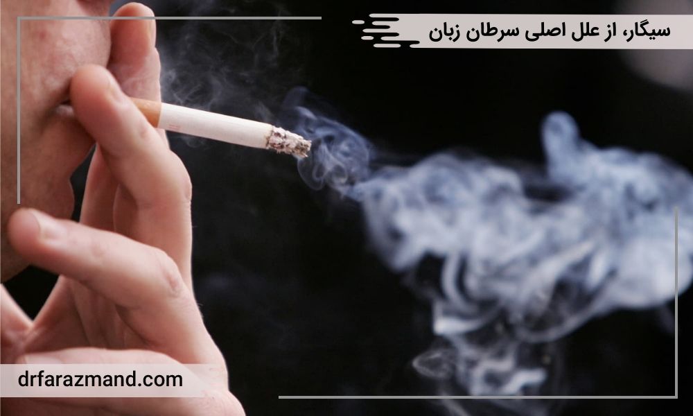 سیگار، علت سرطان زبان
