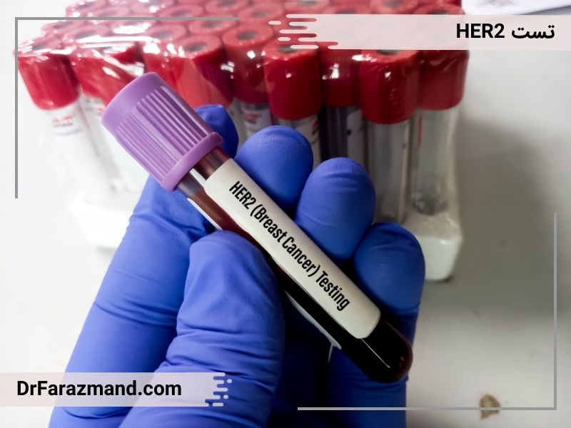 آزمایش HER2 برای تجویز داروهای ضد HER2 مانند هرسپتین و پرجتا