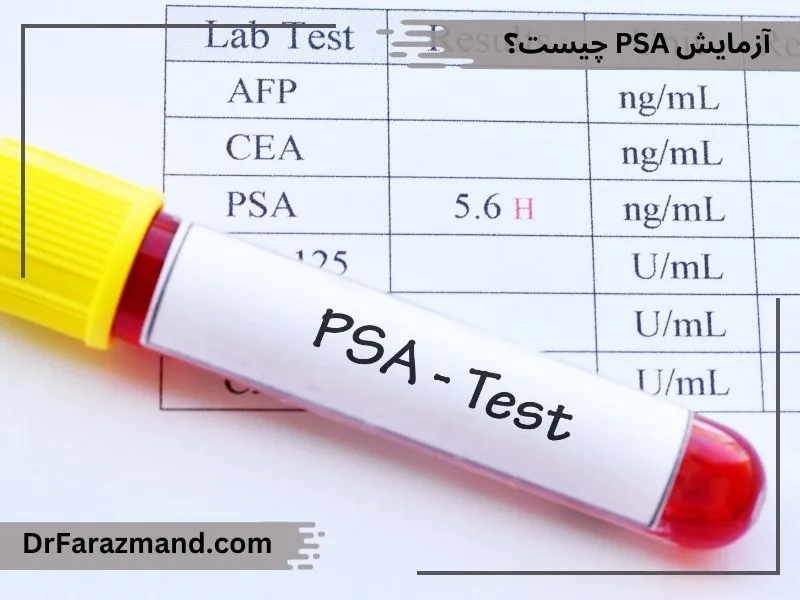 آزمایش PSA چیست، تست PSA چیست، تفسیر جواب PSA، عدد طبیعی PSA چقدر است