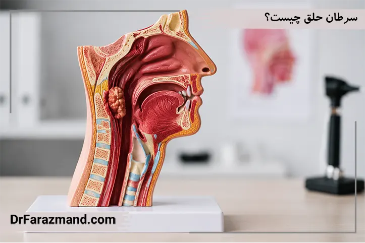 سرطان حلق چیست؟ بررسی انواع سرطان اوروفارنکس، نازوفارنکس و هیپوفارنکس
